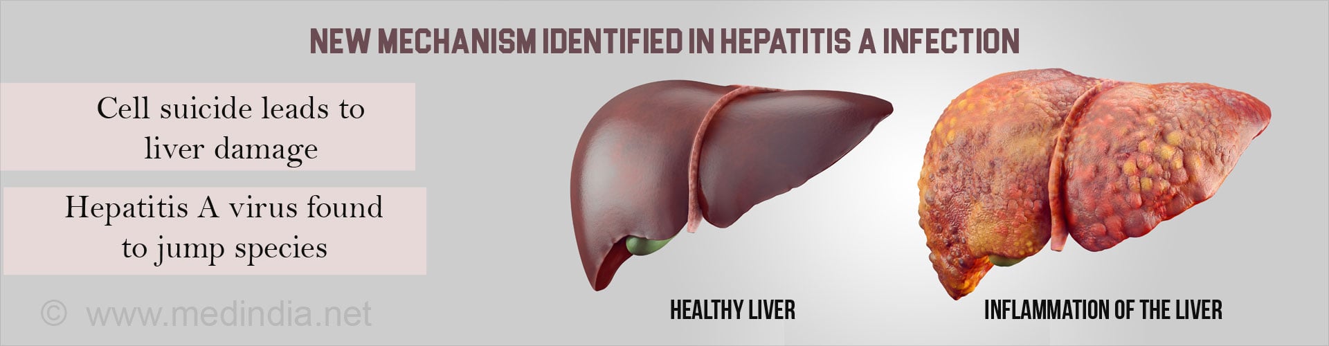 Hepatitis A Virus Causes Liver Injury Due to Liver Cell Suicide