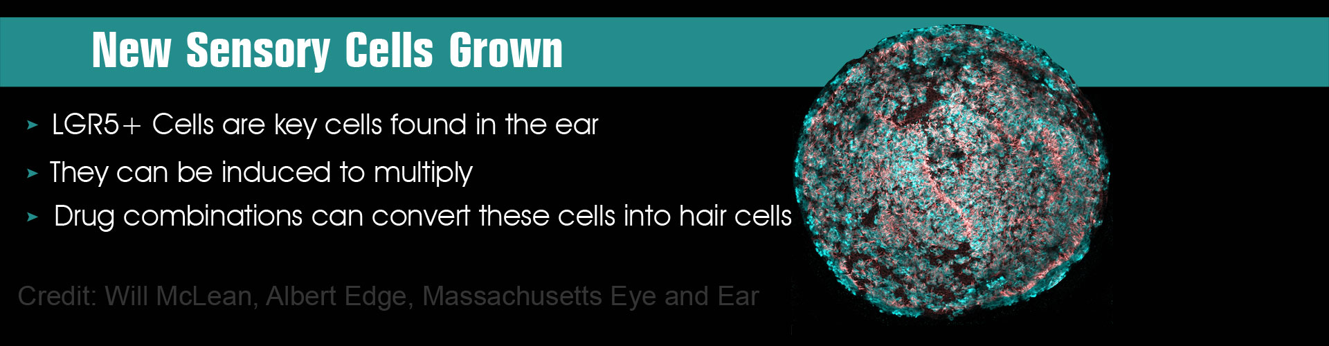 Hearing Loss Can Now Be Treated With New Technique to Grow Sensory Cells