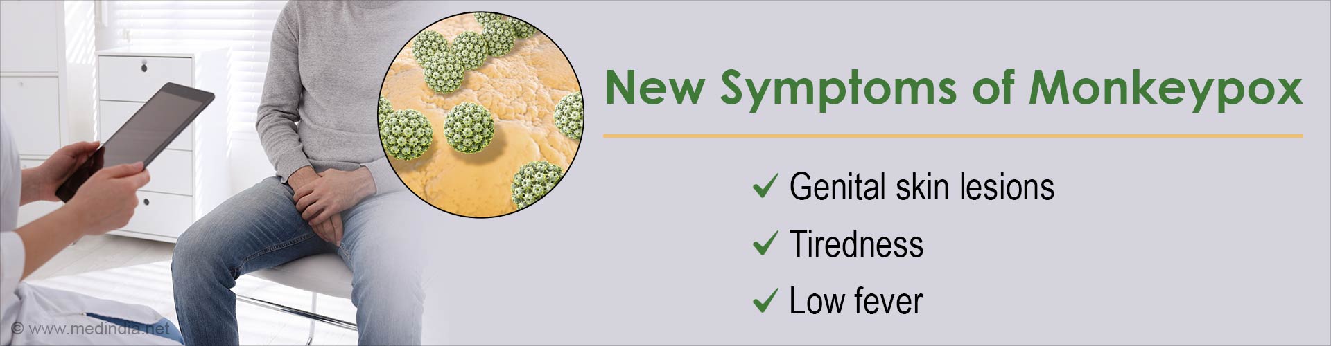 What are The New Symptoms of Monkeypox?