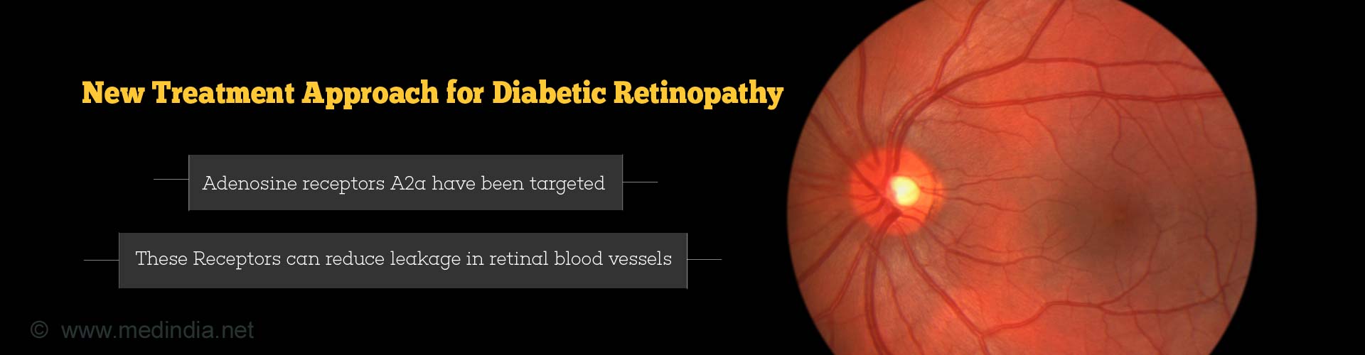 New Target for Diabetic Retinopathy Found