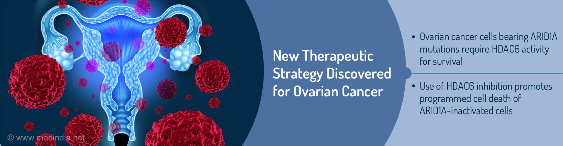 New Treatment For Hard To Treat Ovarian Cancer