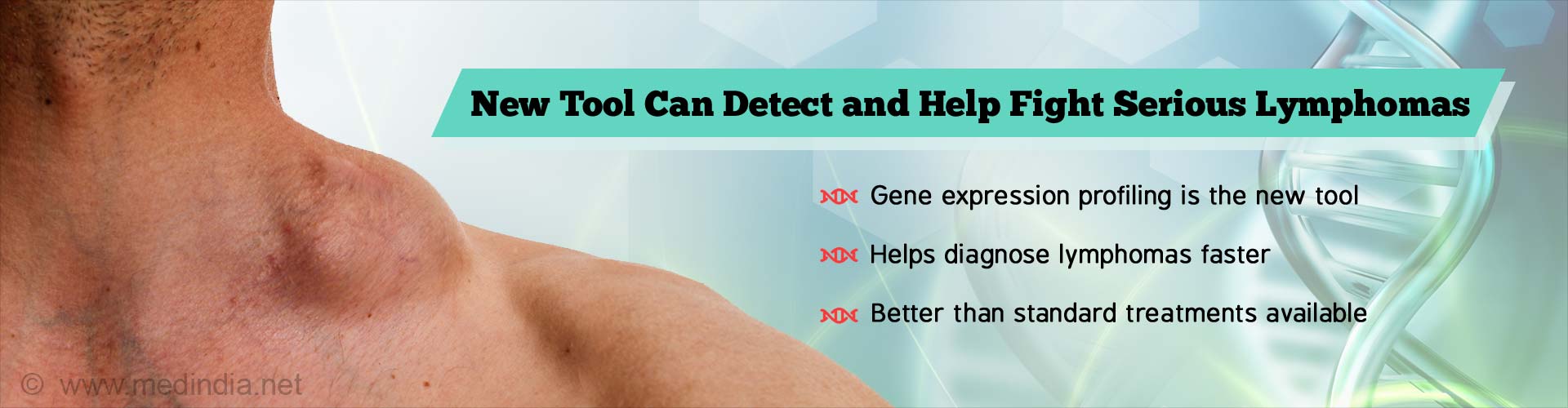 New Tool Can Help Fight Lymphoma - Here''s How New Tool Can Help Fight Lymphoma - Here''s How