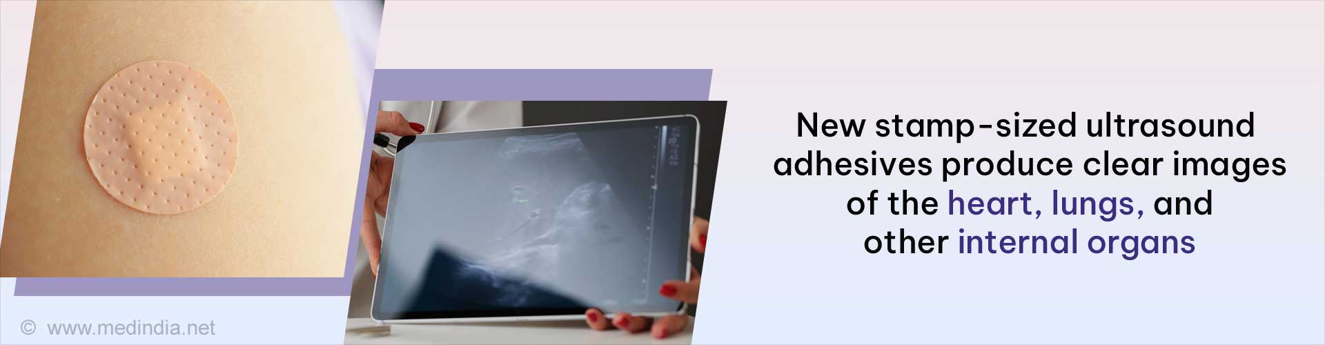 Newly Developed Stickers can Look Through Your Body Newly Developed Stickers can Look Through Your Body