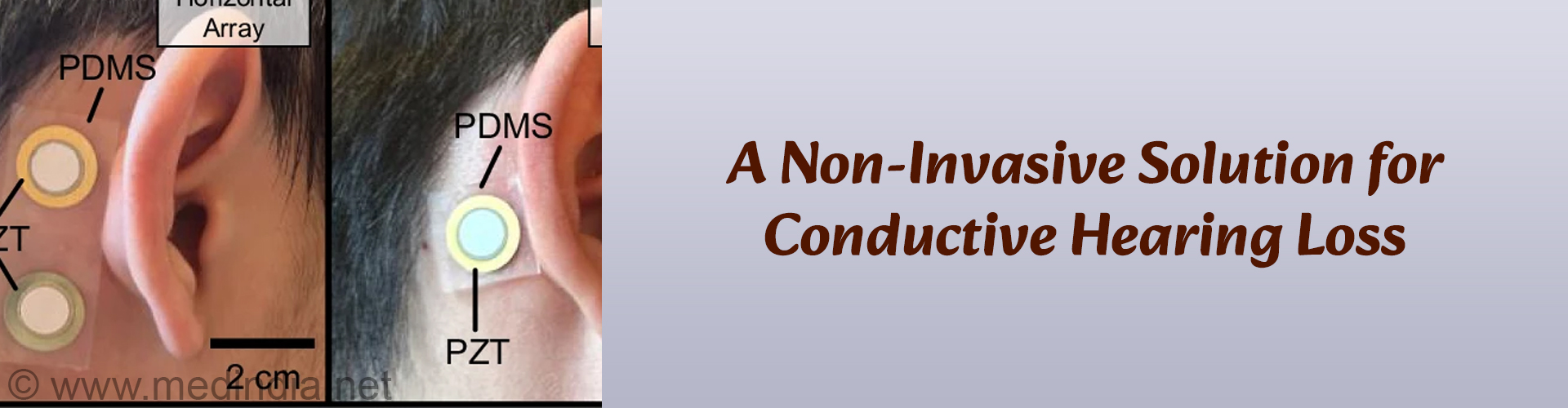Future of Hearing: Flexible, Non-Invasive Hearing Aid