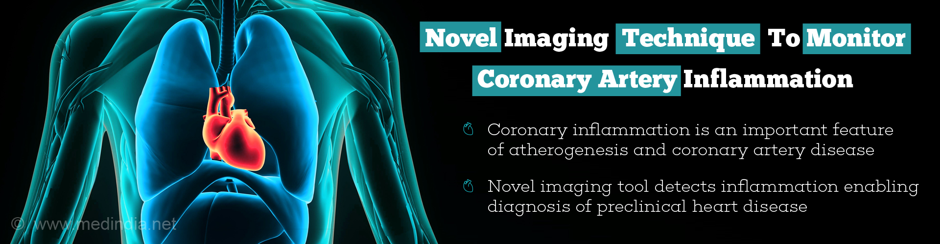 Perivascular Fat Imaging to Predict Coronary Artery Disease Risk Perivascular Fat Imaging to Predict Coronary Artery Disease Risk