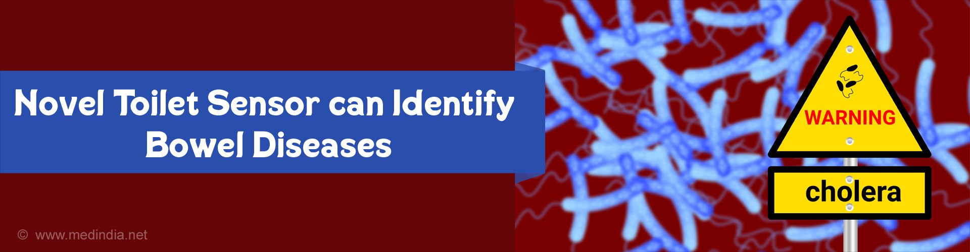 New Sensor Can Identify Bowel Diseases Including Cholera