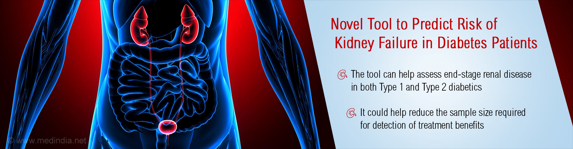 New Tool to Predict Kidney Failure Risk in Diabetes Patients New Tool to Predict Kidney Failure Risk in Diabetes Patients