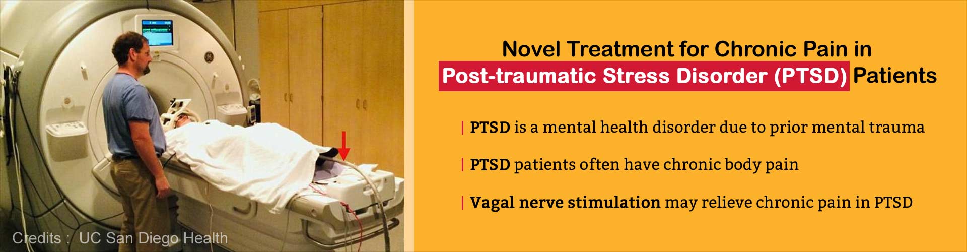 New Treatment for Chronic Pain in PTSD Patients