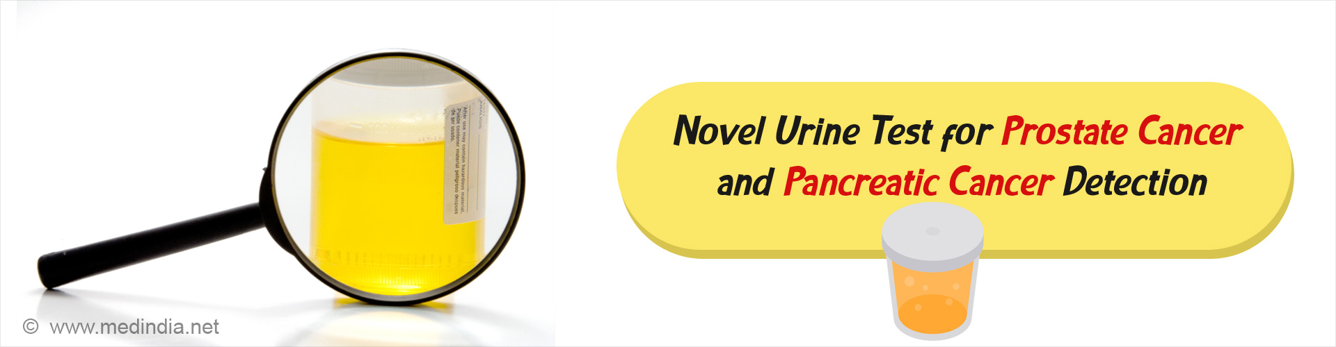 Non-Invasive Urine Test for Cancer Diagnosis