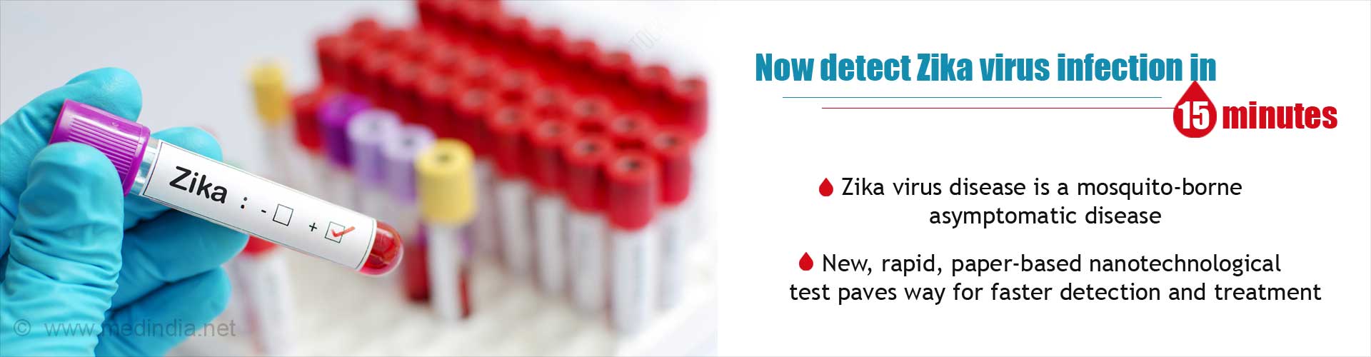 New, Rapid and Inexpensive Test for Zika Virus Detection