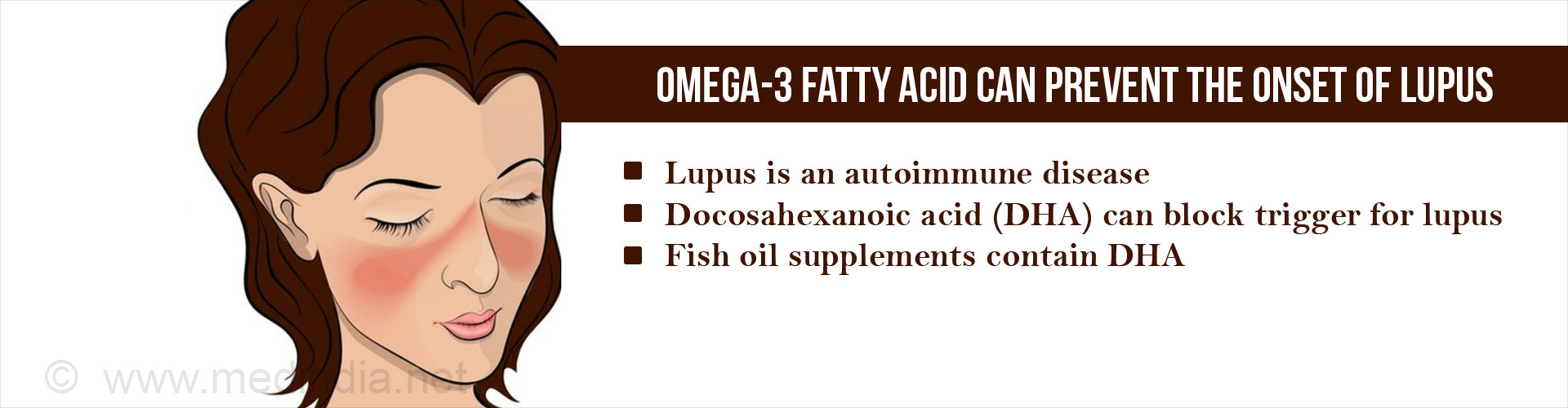 Omega-3 Fatty Acid (Docosahexaenoic Acid) can Prevent Lupus