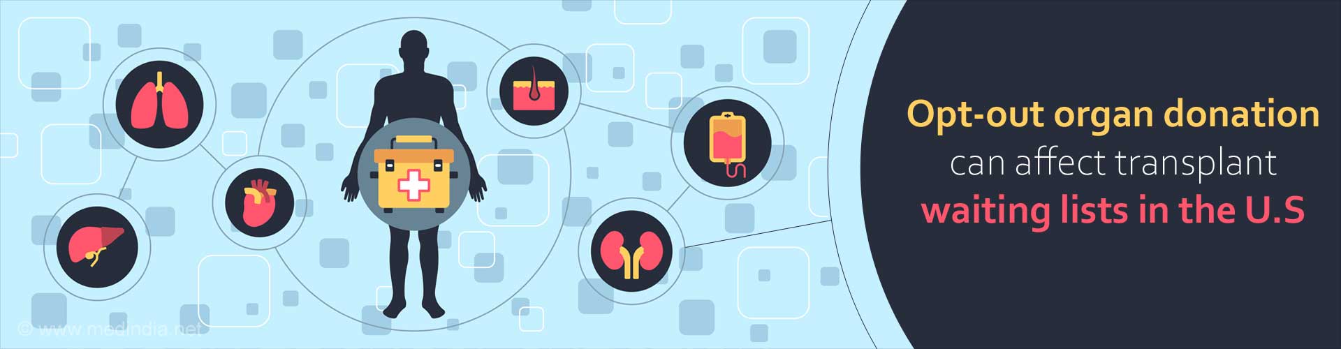 Opt-out Organ Donation Could Affect Transplant Waitlists