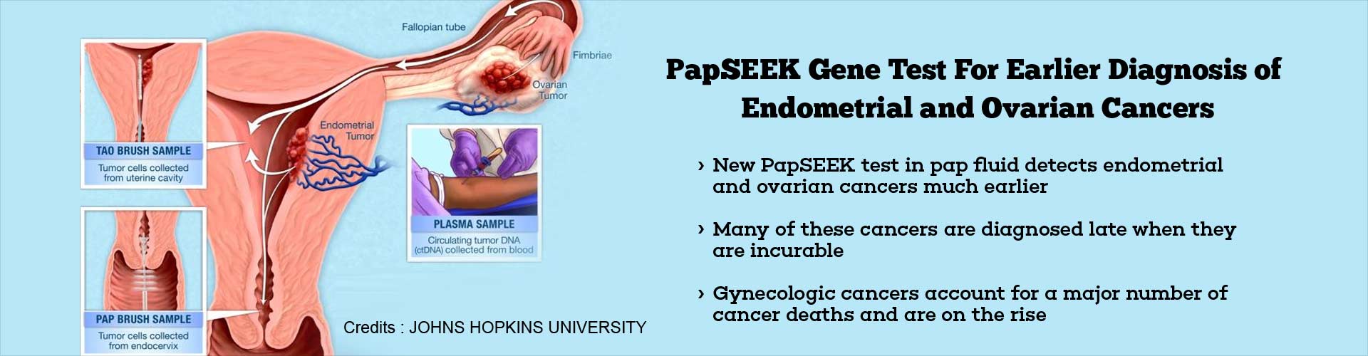 Gene Testing of Pap Test Fluid To Screen for Two Gynecological Cancers