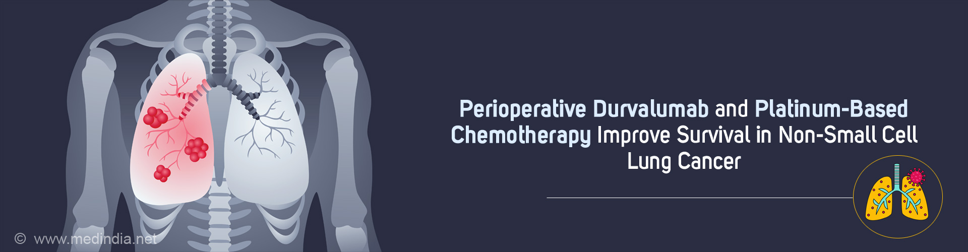 Perioperative Immunotherapy: A Promising Approach for Resectable Lung Cancer