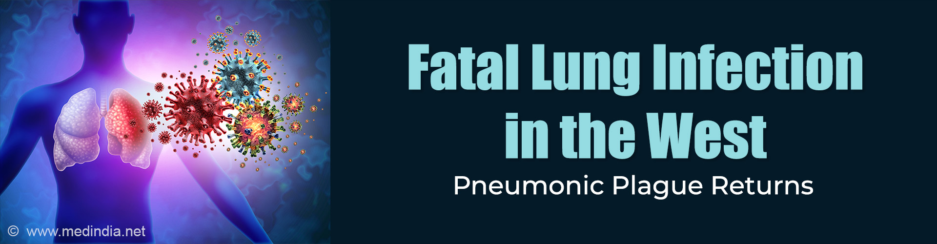 Pneumonic Plague in Arizona: What to Know and How to Stay Safe Pneumonic Plague in Arizona: What to Know and How to Stay Safe