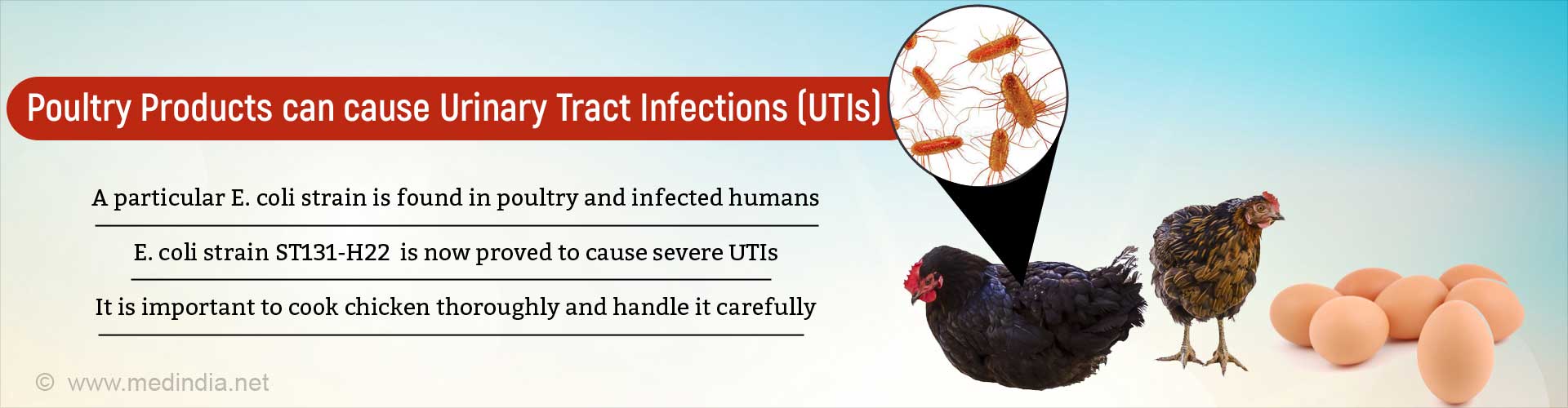 E. Coli from Infected Poultry can Cause Urinary Tract Infection E. Coli from Infected Poultry can Cause Urinary Tract Infection
