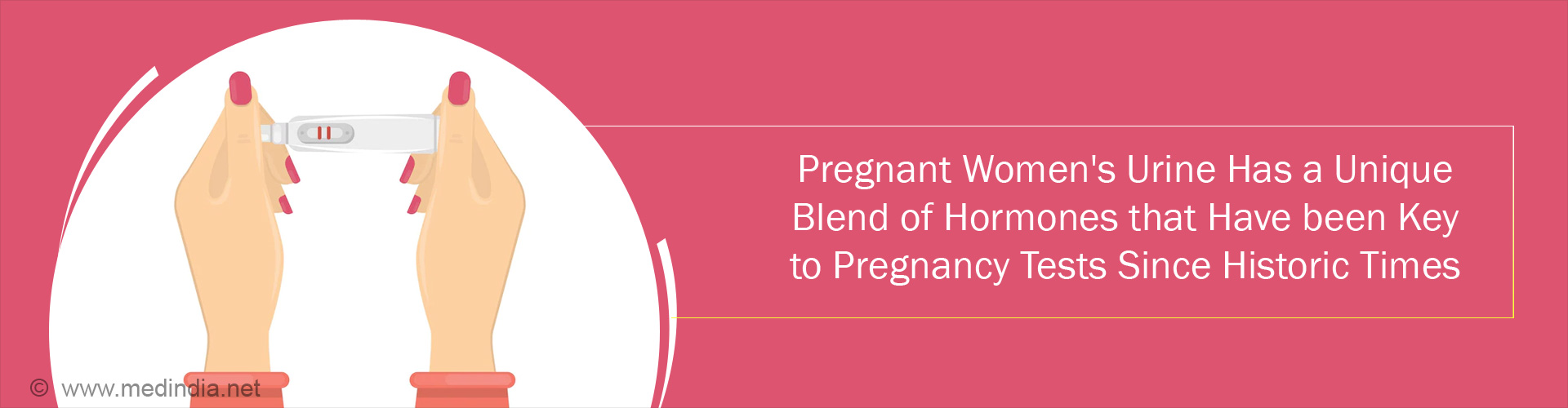 Pee for Pregnant- Urine-Based Pregnancy Tests