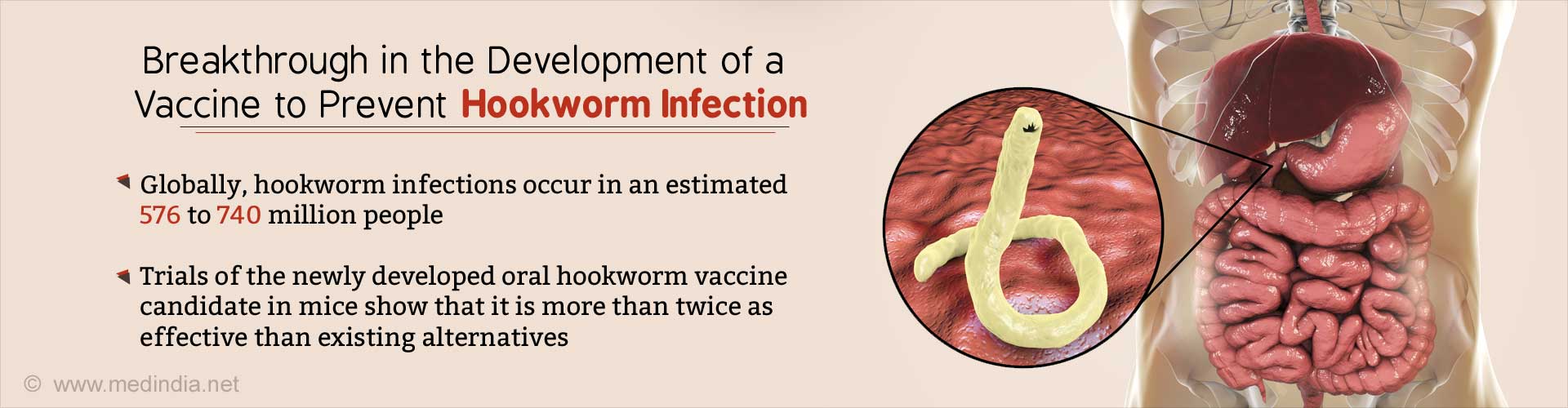 Oral Hookworm Vaccine Developed