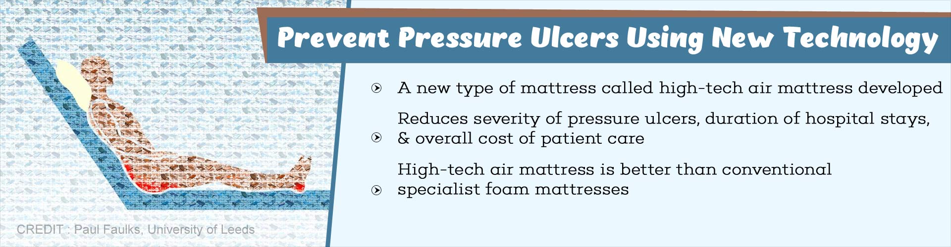 New Way to Treat Pressure Ulcers Effectively