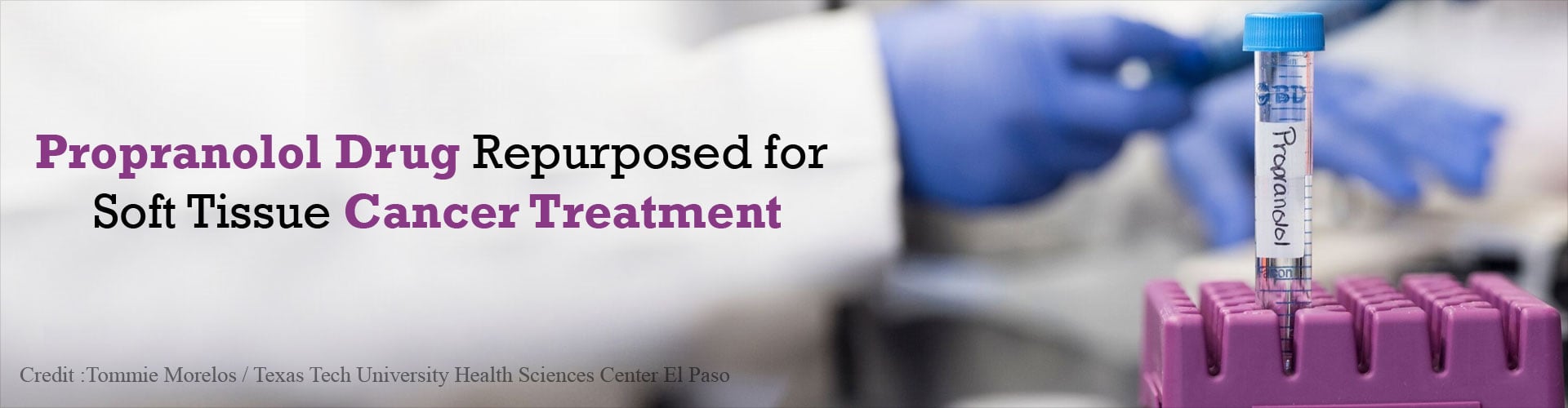 Common Blood Pressure Drug Repurposed for Rare Cancer Treatment Common Blood Pressure Drug Repurposed for Rare Cancer Treatment