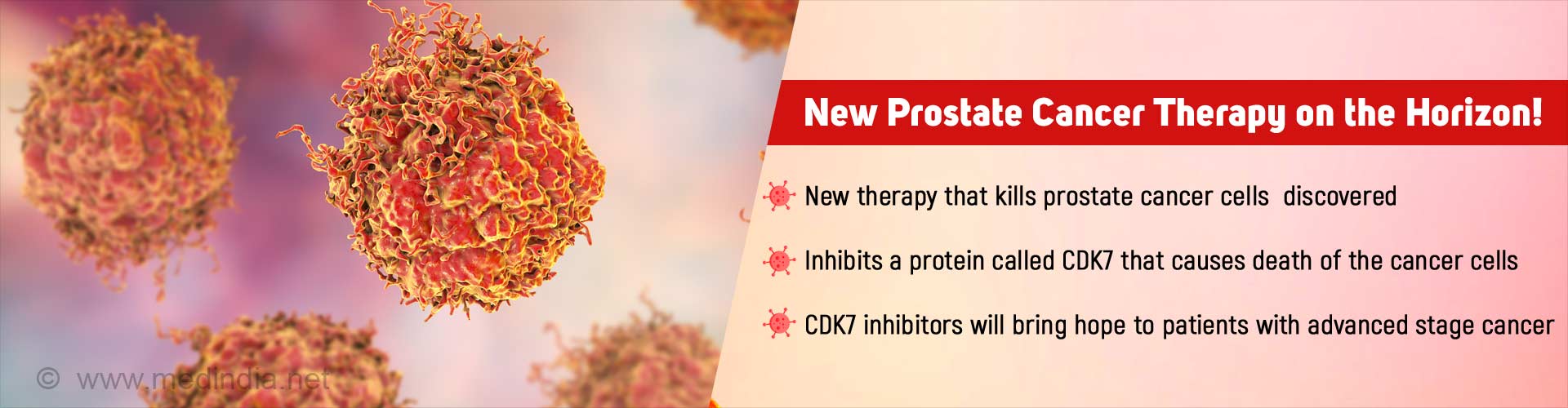 New Treatment for Prostate Cancer Could Soon be Available New Treatment for Prostate Cancer Could Soon be Available