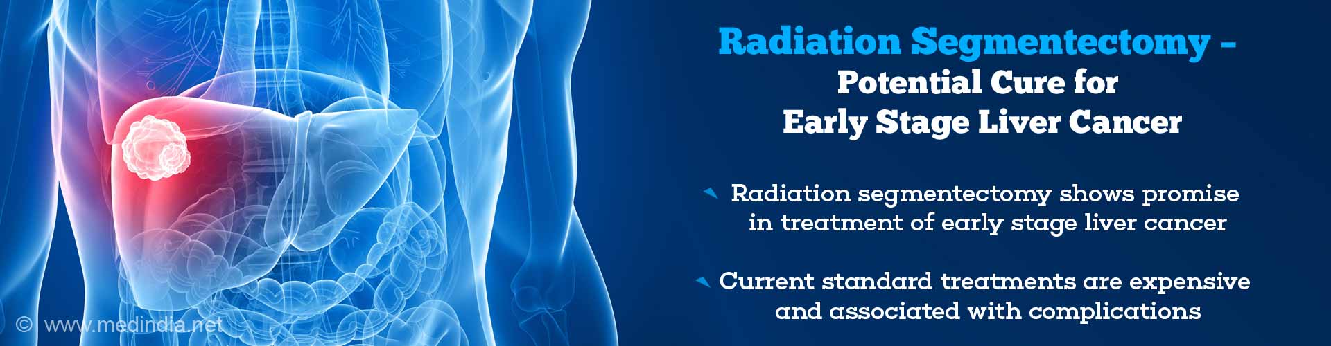 New Radiotherapy Treatment Option for Liver Cancer New Radiotherapy Treatment Option for Liver Cancer