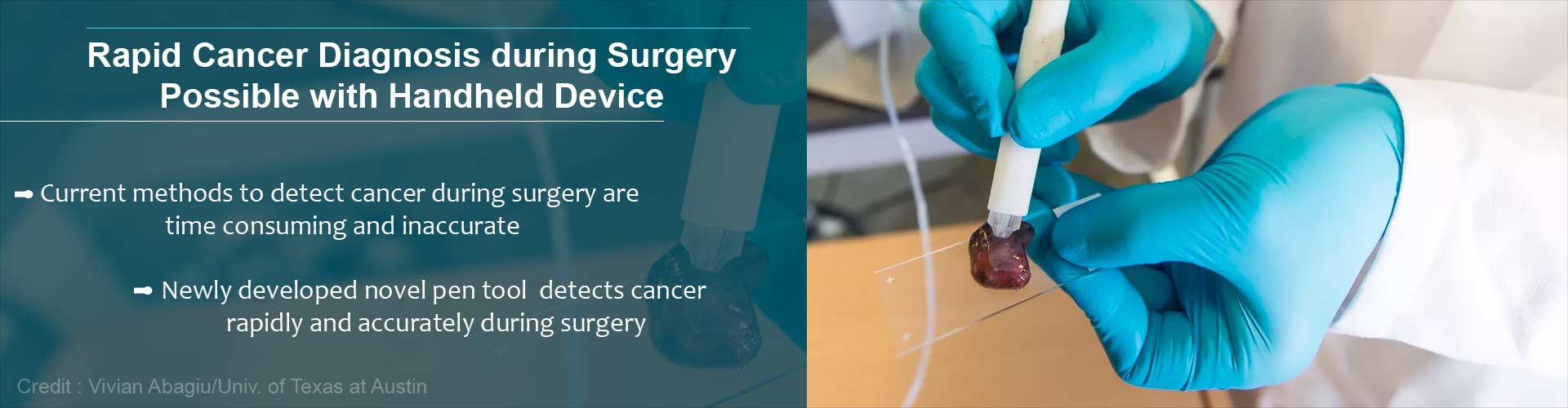 Novel Tool To Identify Cancerous Tissue During Surgery Developed