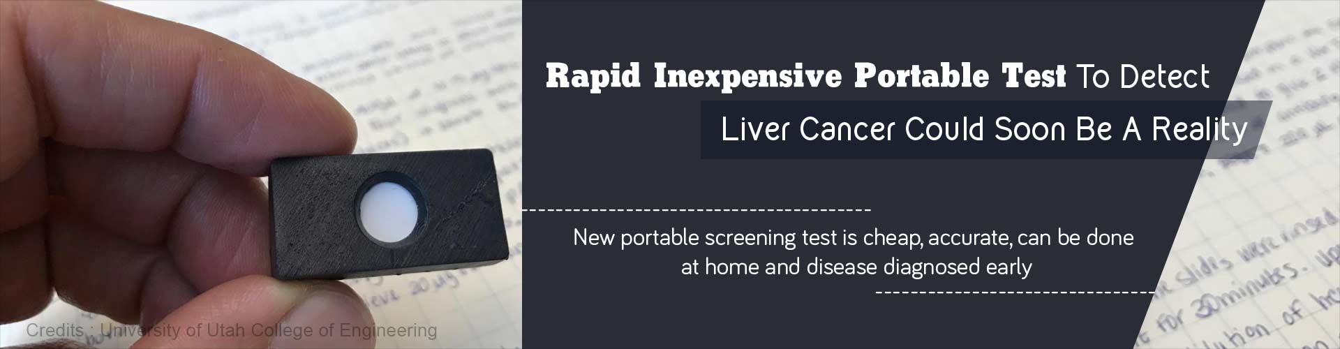 Detection of Liver Cancer Possible With Rapid Home Blood Test