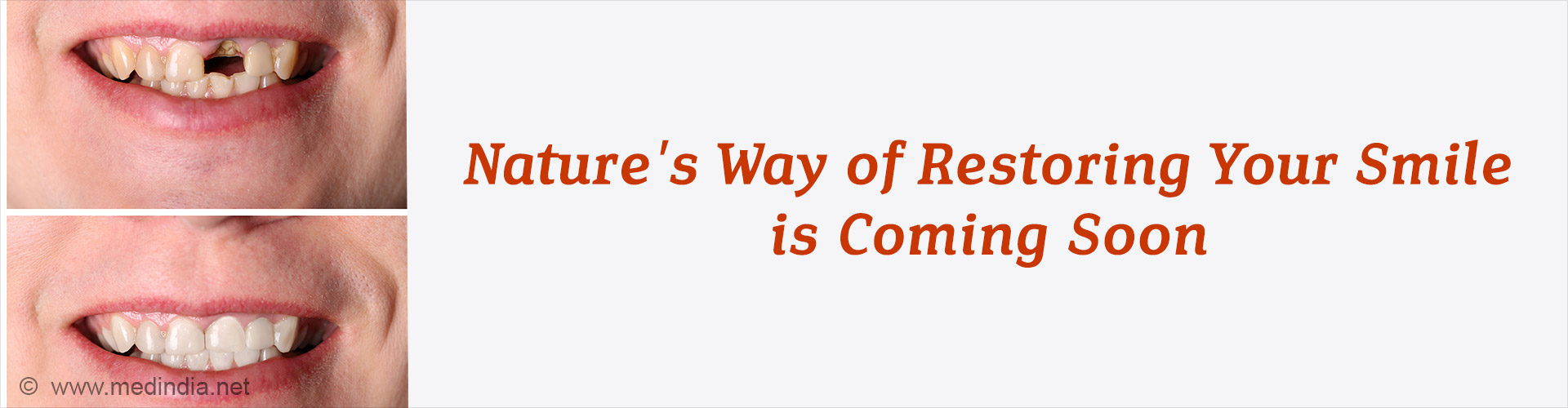 The Future of Dentistry Is Almost Here