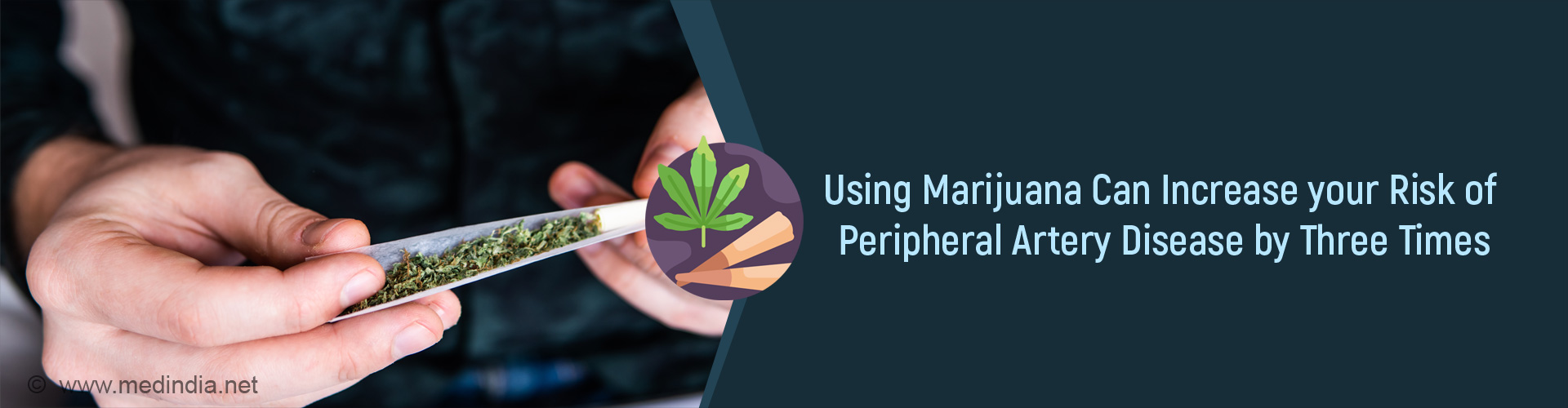 Marijuana Use Could be a One-Way Ticket to Peripheral Artery Disease Marijuana Use Could be a One-Way Ticket to Peripheral Artery Disease