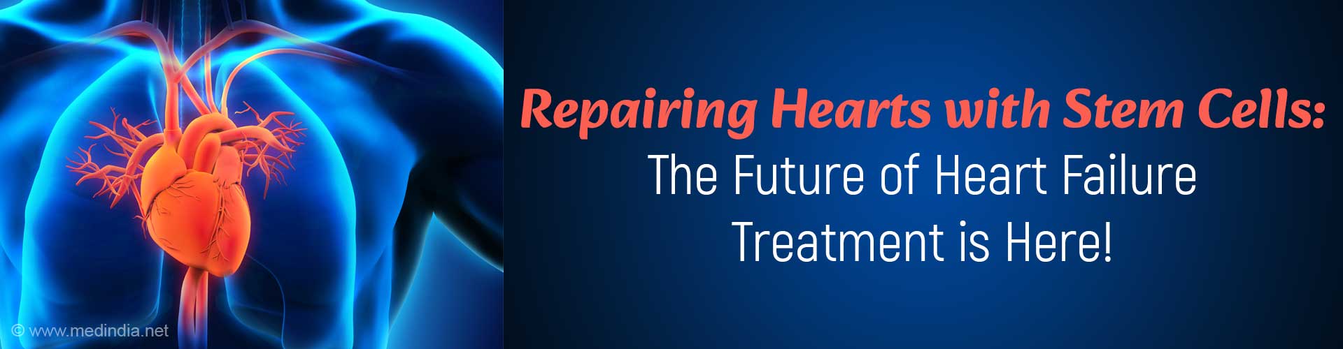 Stem Cell-Based Heart Repair : A Breakthrough for Heart Failure