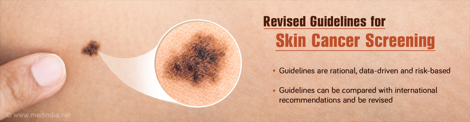 Skin Cancer Screening : Data-Driven Guidelines Proposed
