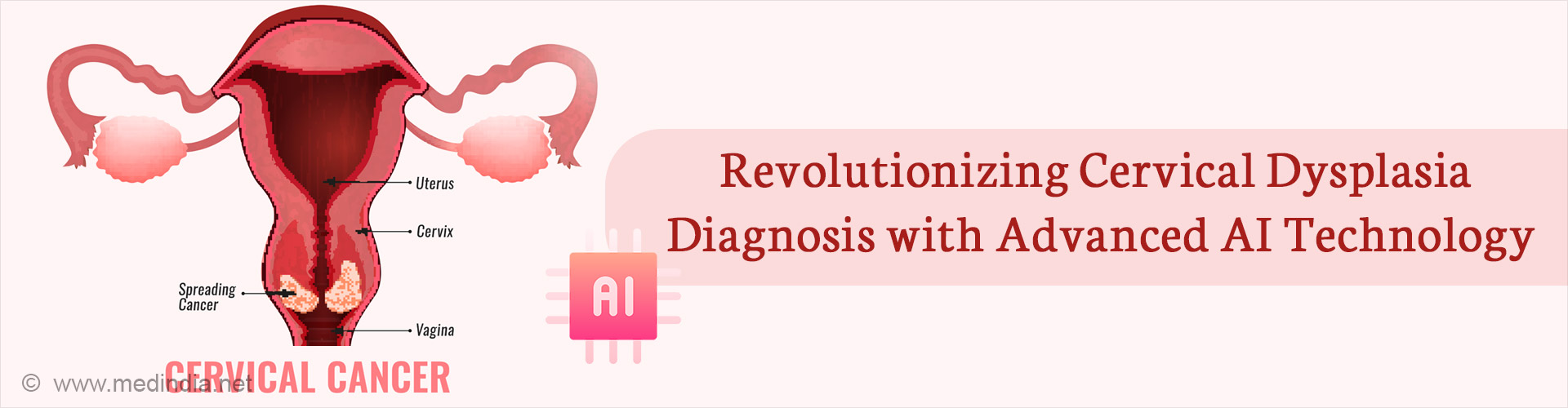 New AI Model With 98% Accuracy in Cervical Cancer Detection
