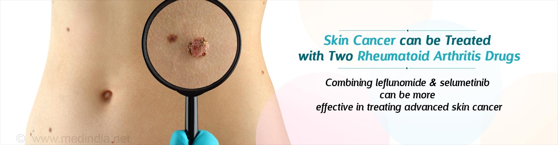 Rheumatoid Arthritis Drugs Can Help Treat Advanced Skin Cancer Rheumatoid Arthritis Drugs Can Help Treat Advanced Skin Cancer