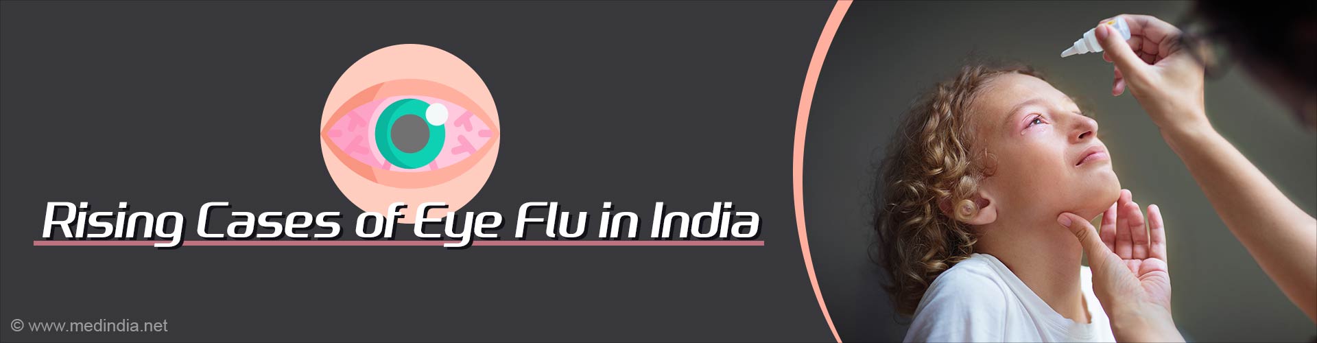 Eye Flu Surge Amid India's Flood Crisis