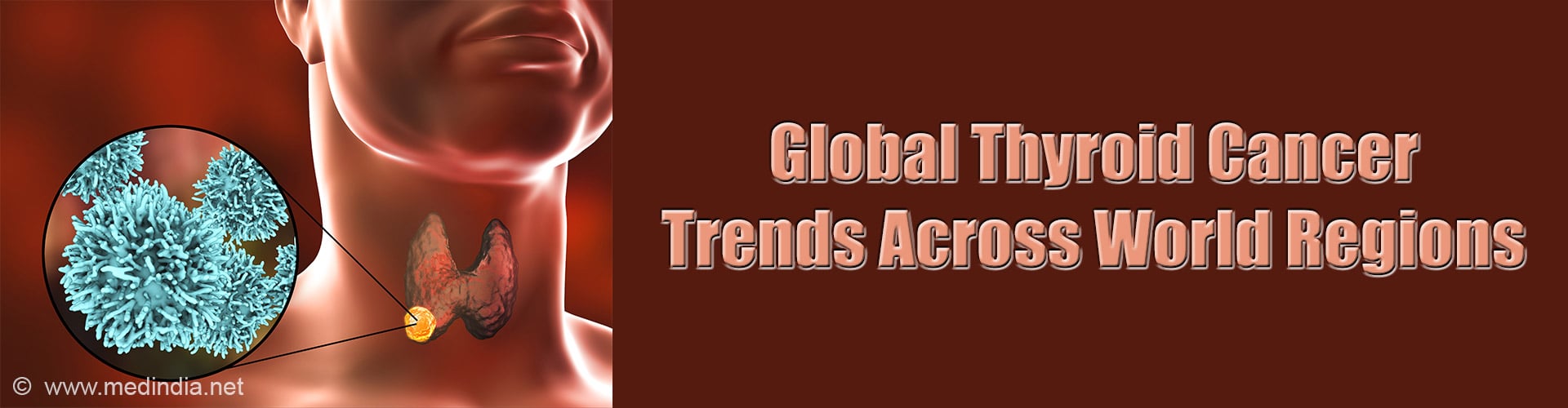 Study Warns of Rising Thyroid Cancer Rates Worldwide