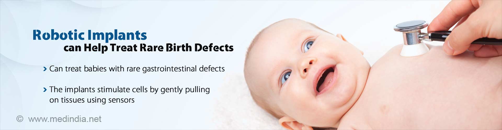 Robotic Implants may now Treat Congenital Gastrointestinal Defects Robotic Implants may now Treat Congenital Gastrointestinal Defects
