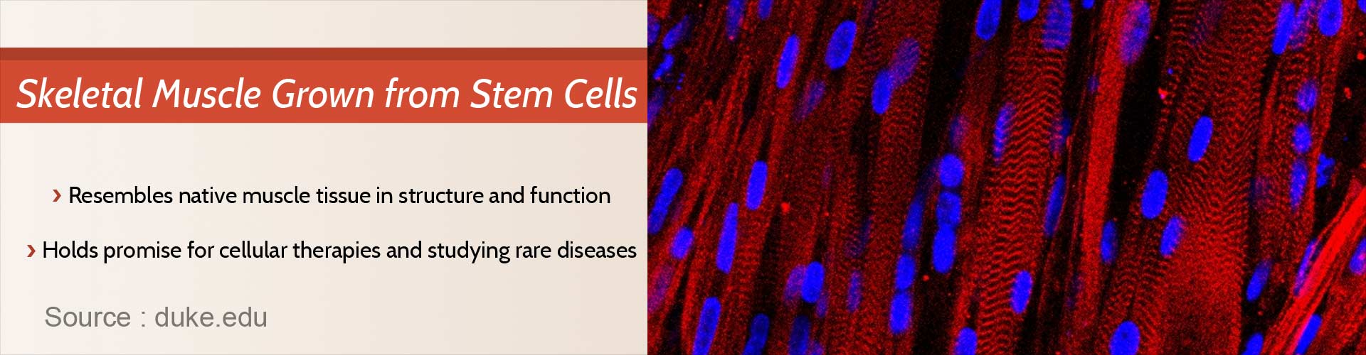 Human Muscle Grown from Skin Cells Human Muscle Grown from Skin Cells