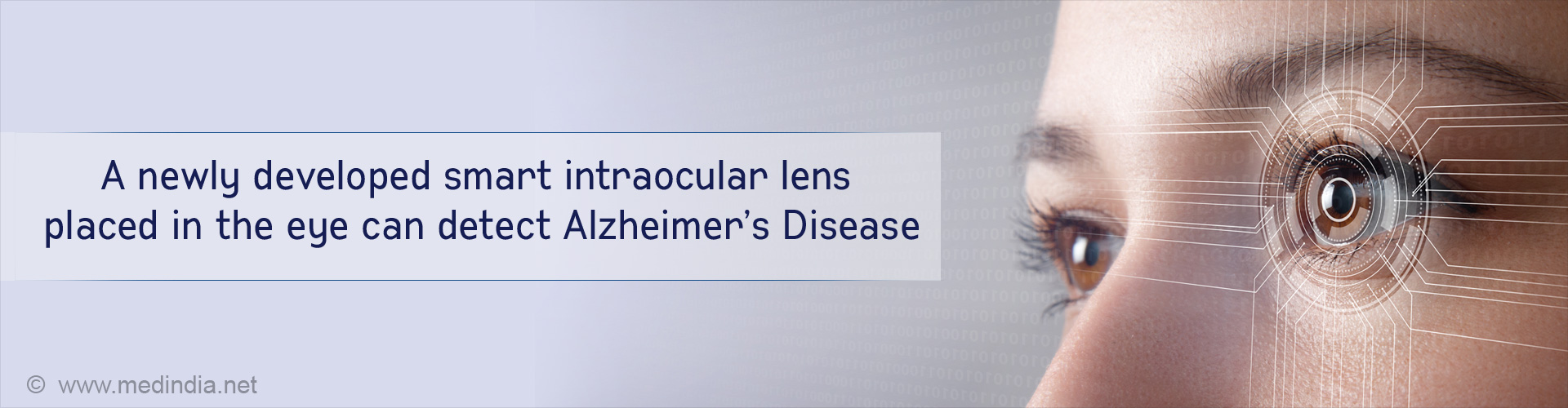 Smart Lens to Detect Alzheimer's Disease Developed