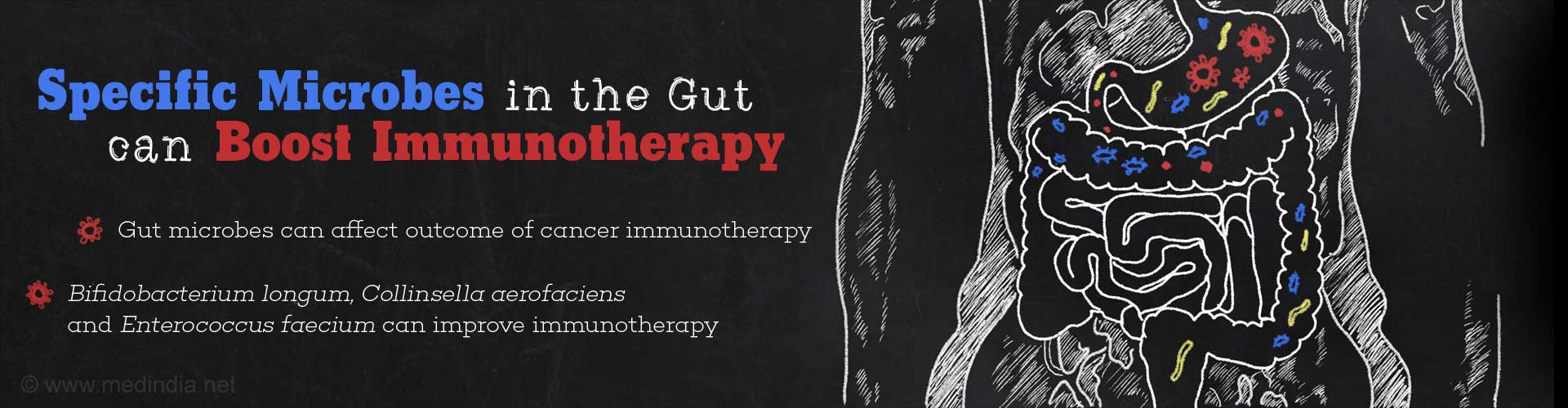 Gut Microbiome Influences Efficacy of Cancer Immunotherapy Gut Microbiome Influences Efficacy of Cancer Immunotherapy