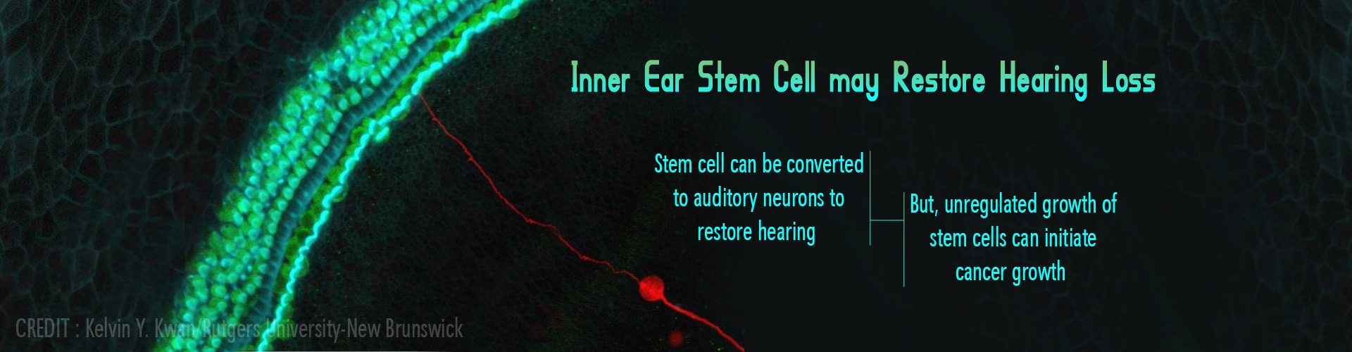 Inner Ear Stem Cells may Restore Hearing in Future