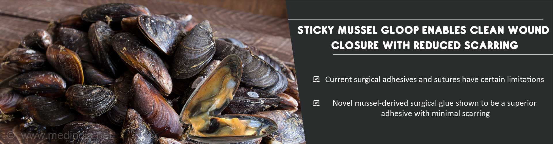 Innovative Surgical Glue With Reduced Scarring : Sticky Mussel Protein Innovative Surgical Glue With Reduced Scarring : Sticky Mussel Protein