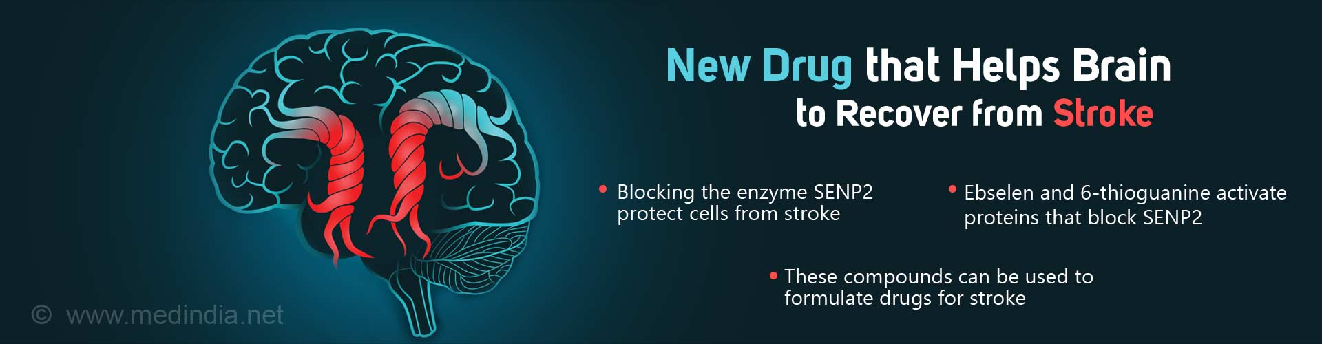Stroke Treatment Based On Brain Cells of Hibernating Ground Squirrels Stroke Treatment Based On Brain Cells of Hibernating Ground Squirrels