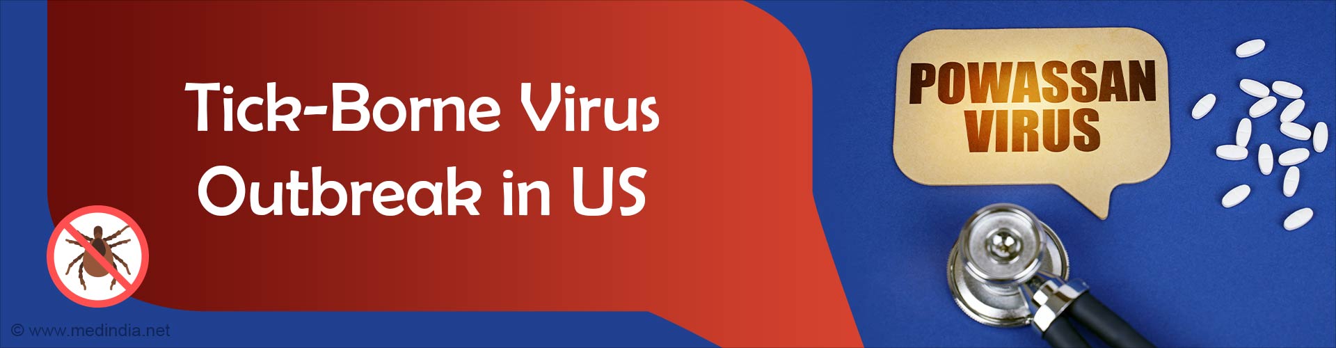 Powassan Virus Disease: Explained
