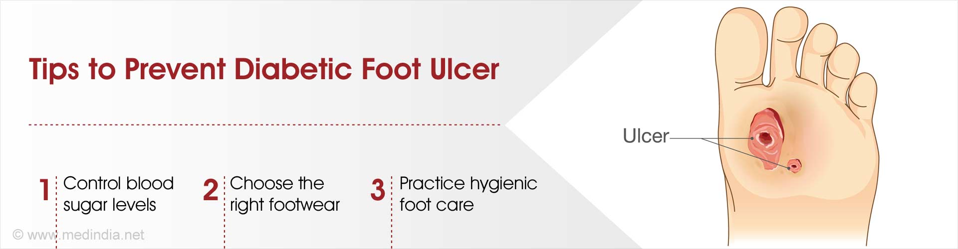 Diabetic Foot Ulcers can be Life-threatening - Interview With a Podiatrist