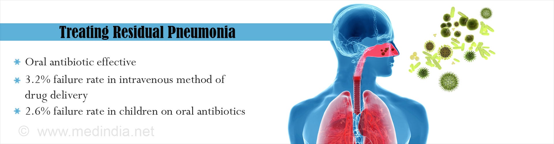 Complex Pneumonia Requires Simple Oral Antibiotic Therapy for Residual Disease