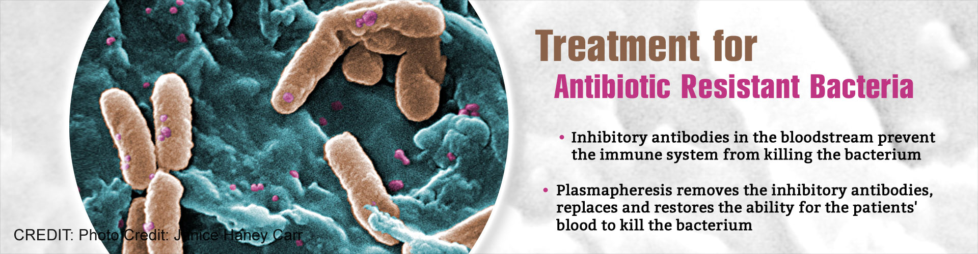 New Treatment for Antibiotic Resistant Bacteria New Treatment for Antibiotic Resistant Bacteria