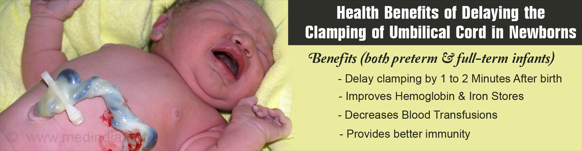 Delay Clamping of Cord by 1 to 2 Minutes in Newborn