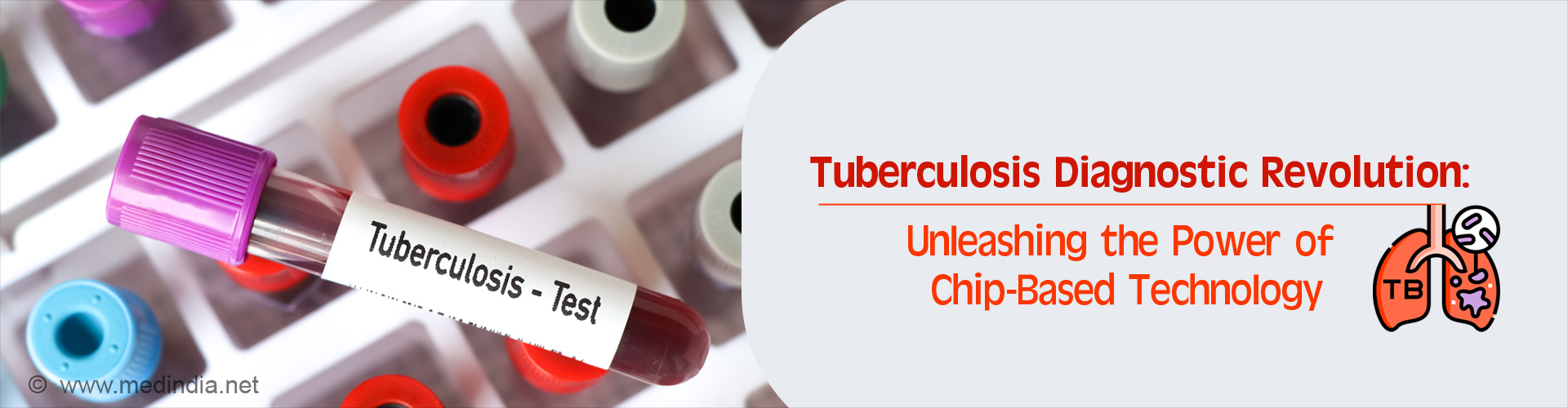 Novel Portable Solution for Tuberculosis Diagnosis