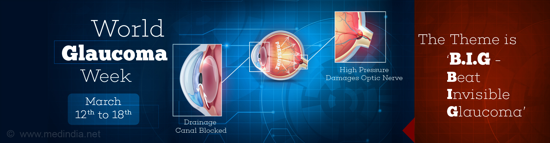 World Glaucoma Week March 12th- 18th 2017: Exclusive Interview With Dr. B. Shantha World Glaucoma Week March 12th- 18th 2017: Exclusive Interview With Dr. B. Shantha